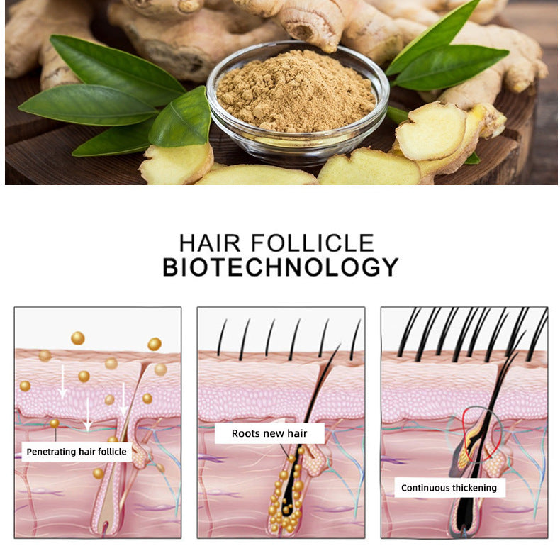 Haarwachstumsöl Oem Haarpflege ätherisches Öl